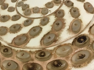 Hospital Biofilm Removal